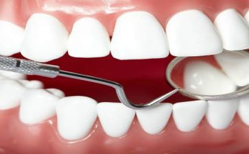 920爱牙日活动总结通用6篇